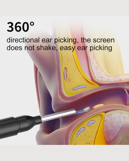 HD Visual Ear Pick with Camera and USB Charging